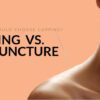 Cupping vs. Acupuncture 